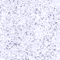 [Link to bg_speckle_blue.jpg, 80x80 {3k}]